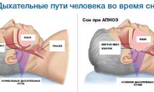 Что такое Апноэ