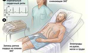 Что такое электрокардиограмма сердца