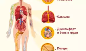 Как выявить и как лечить сердечно-лёгочную недостаточность