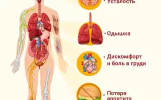 Как выявить и как лечить сердечно-лёгочную недостаточность