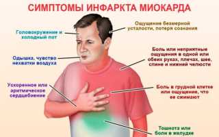 Симптомы инфаркта миокарда на разных стадиях
