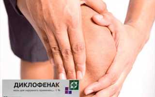 От чего помогает мазь «Диклофенак»