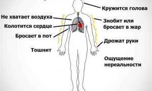 Признаки вегето-сосудистой дистонии