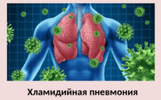 Респираторный хламидиоз: что это такое, источник заражения и опасность,