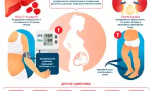 Токсикоз при беременности