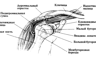 Субклювовидный бурсит плечевого сустава, что это такое, лечение