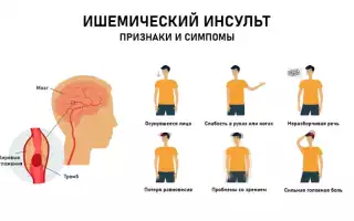 Какие нарушения может вызвать ишемический инсульт
