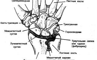 Причины развития синовита лучезапястного сустава