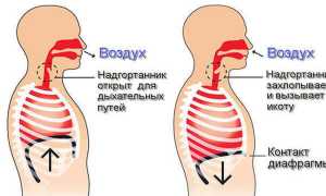Как избавиться от икоты