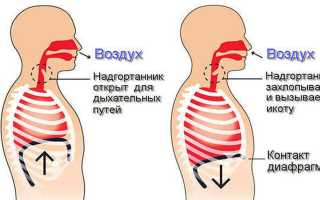 Как избавиться от икоты