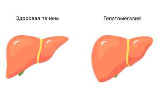 Почему увеличена печень?