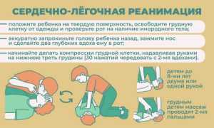 Первая помощь ребенку летом