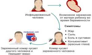 Вирус Зика — болезнь из Уганды
