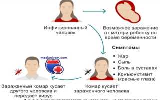 Вирус Зика — болезнь из Уганды