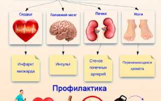 Последствия атеросклероза сердца, назначение лечения