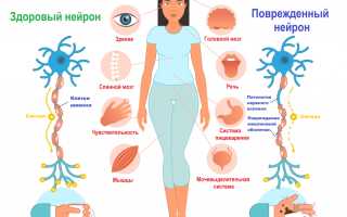 Что такое Рассеянный склероз