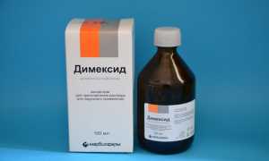 Как лечить пяточную шпору Димексидом