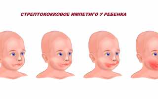 Чем различаются герпес и стрептодермия, есть ли различия в лечении?