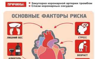 Факторы риска инфаркта миокарда