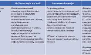 Правильное лечение миокардита обеспечивает положительный прогноз течения болезни
