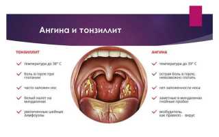 Может ли гнойная ангина стать причиной тяжелых поражений сердца