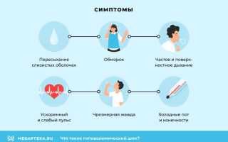 Гиповолемический шок – можно ли спасти человека