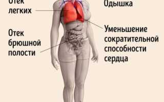 Чем может быть опасна застойная сердечная недостаточность