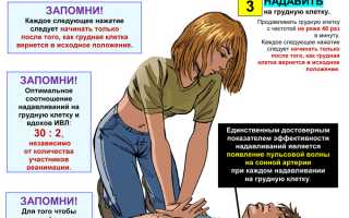 Нужно ли делать непрямой массаж сердца человеку, у которого случился обморок