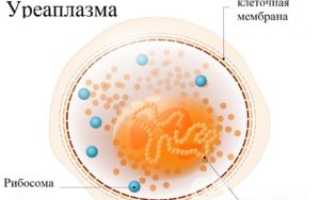 Уреаплазма у женщин: источник инфекции, виды, симптомы, методы диагностики, лечение, профилактика