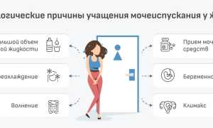 Частое мочеиспускание без боли