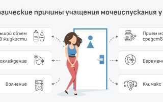 Частое мочеиспускание без боли