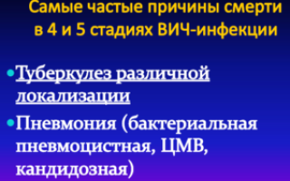 Пневмония у вич-инфицированных: причины пневмоцистной, симптомы, диагностика и лечение