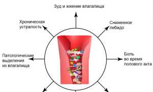 Лечение кольпита