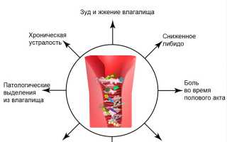 Лечение кольпита