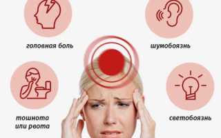 Что такое мигрень – симптомы и лечение этого заболевания (часть I: симптомы и признаки)