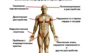 Особенности нейроциркуляторной дистонии