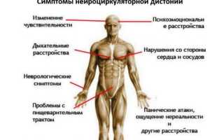 Особенности нейроциркуляторной дистонии
