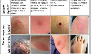 Укус овода — что делать?