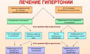 Способы лечения гипертонии