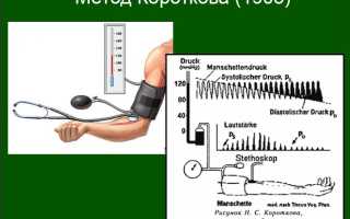Определение артериального давления по методу Короткова методика и ее особенности