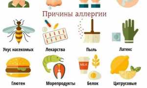 Аллергия — защитная реакция организма