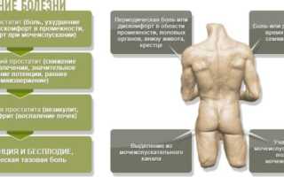 Препараты для лечения простатита: обзор самых эффективных средств