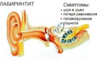 Причины и методы лечения сильного головокружения