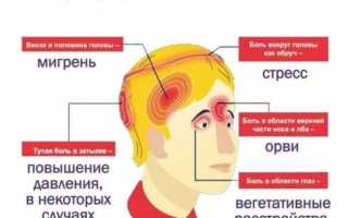 Боль в виске