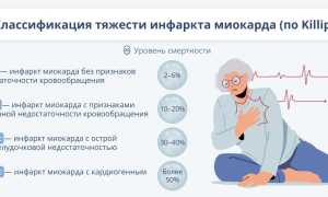 Лечение инфаркта миокарда, реабилитация