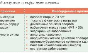 Диастолическая дисфункция: причины, симптомы, диагностика и лечение