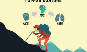 Что такое горная болезнь