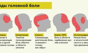 Виды головной боли