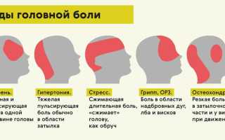 Виды головной боли