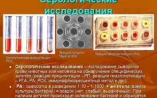 Уреамикоплазмоз: что это такое, способы передачи, опасность, симптомы, диагностика, лечение